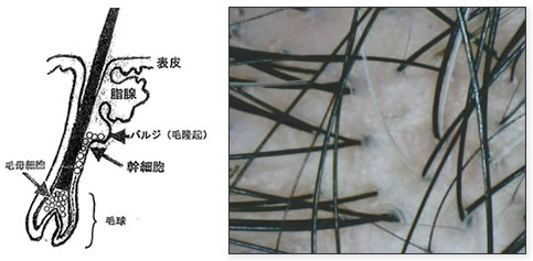 白髪の断面図と頭皮の拡大