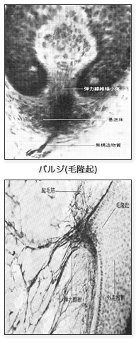 バルジの図