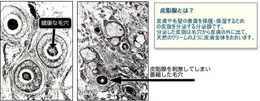 皮脂腺の図