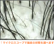 頭皮の拡大写真