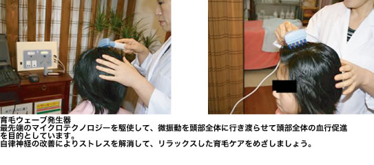 子供の薄毛 手当法3