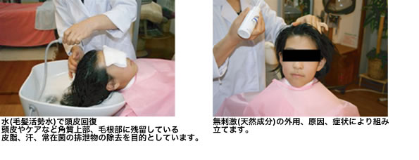 子供の薄毛 手当法2