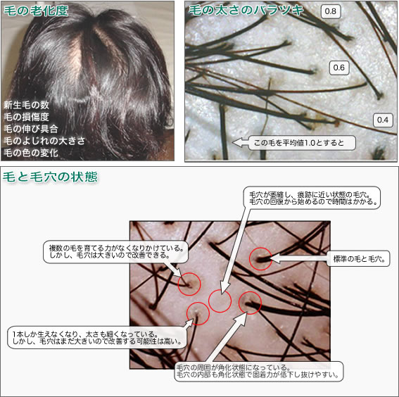 毛の状態